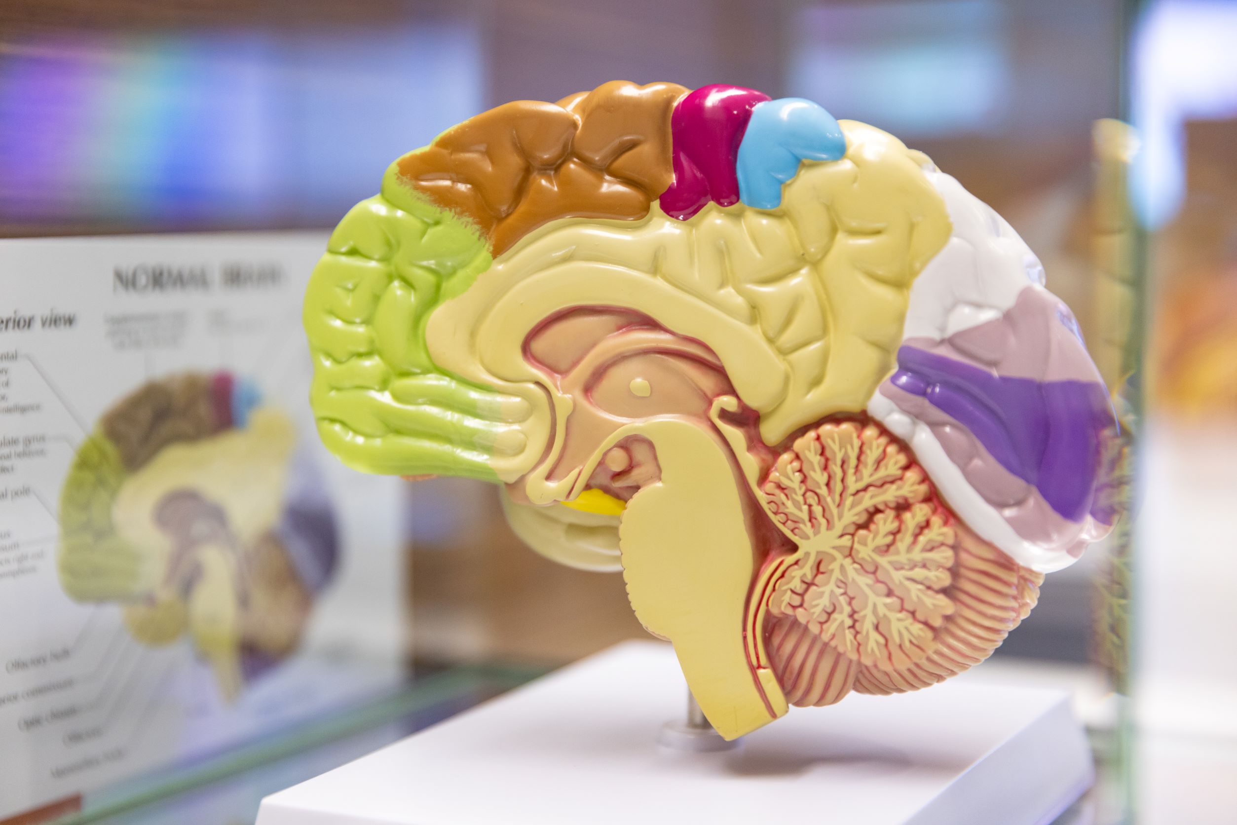 Colorful brain display case