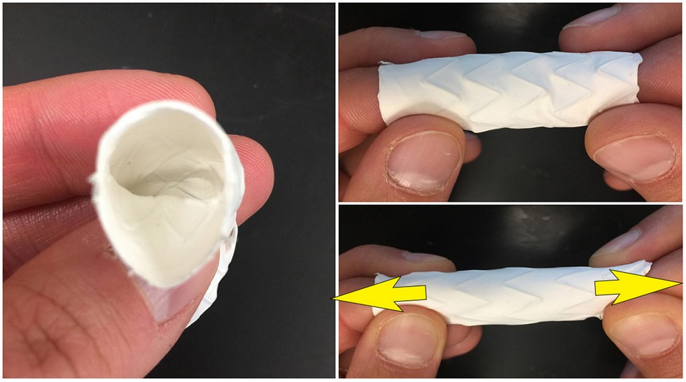 aortic-stent-graft-that-preserves-elasticity.jpg