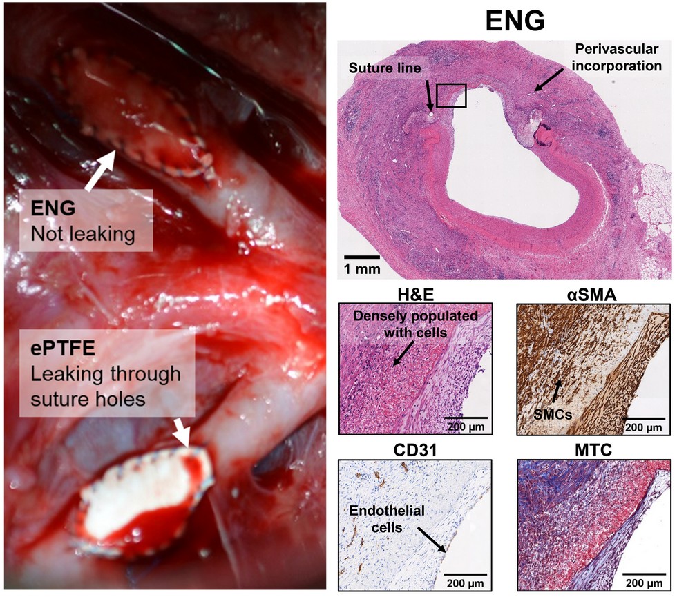 mechanically-tuned-vascular-grafts.jpg