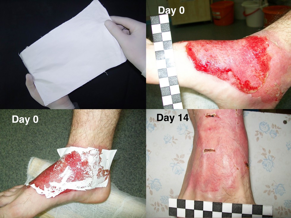 wound-dressings.jpg