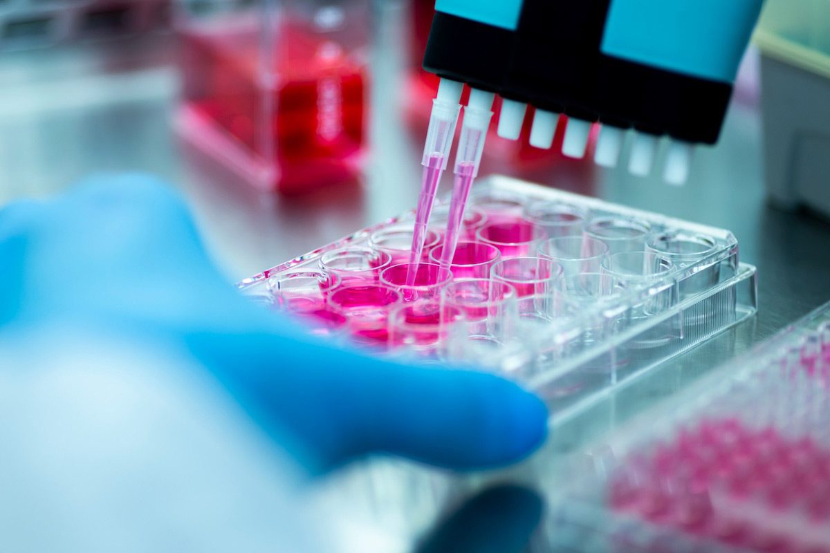 A close-up of a scientist wearing a blue glove using a multichannel pipette to transfer bright pink liquid into a 96-well plate in a laboratory setting. 