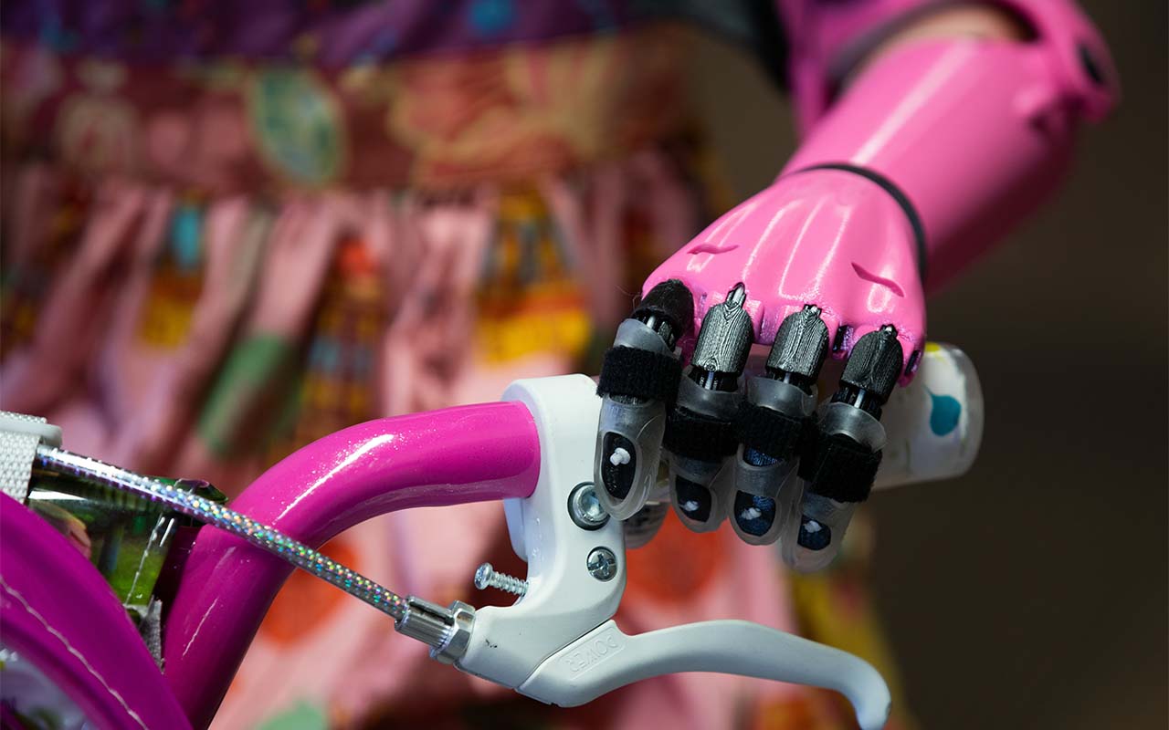 Close-up photo of Rue's prosthetic arm, which was designed, custom-fit, and 3D-printed at UNO's Biomechanics Research Building. Using it, she can hold onto both handlebars while riding a bike.